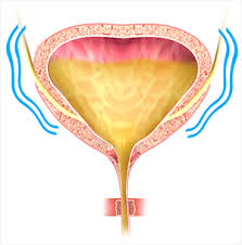 Urinary and bladder incontinence